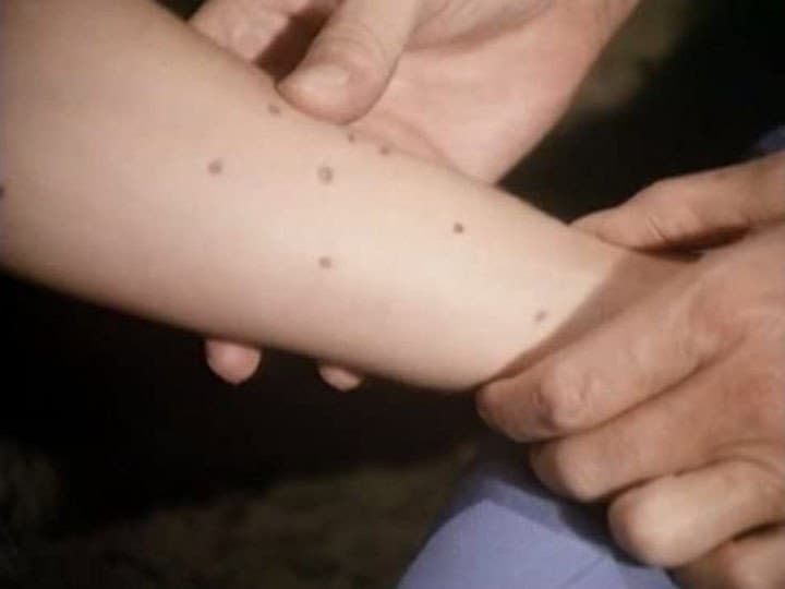 Still from The Chemistry of Hope
