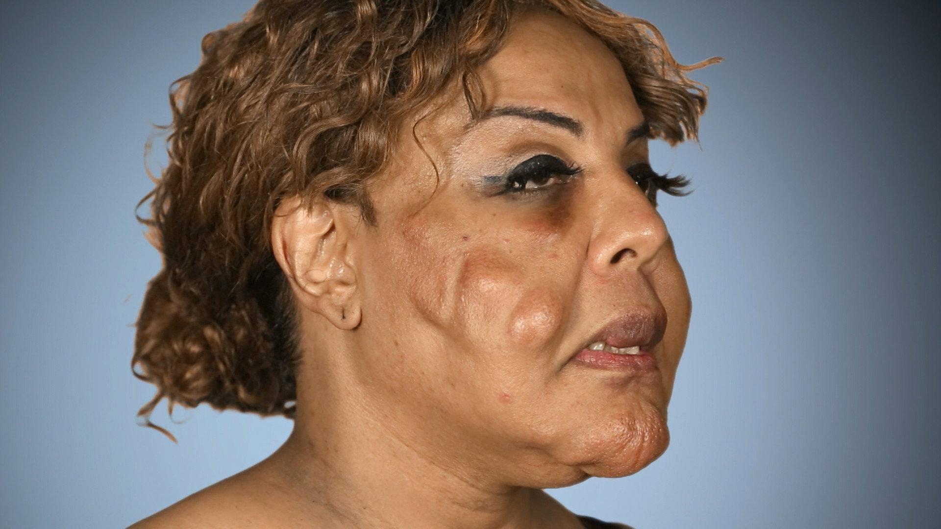 Still from Foreign Bodies