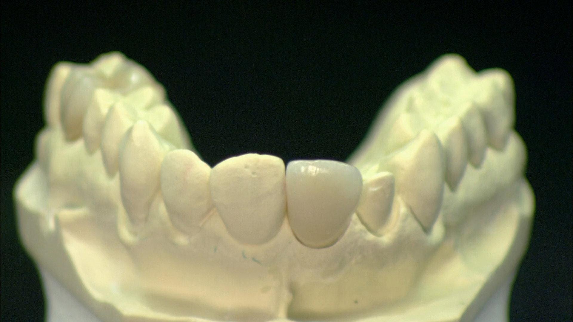 Still from Kelp Caviar, Luxury Sailboats, Dental Crowns, High-Performance Engines