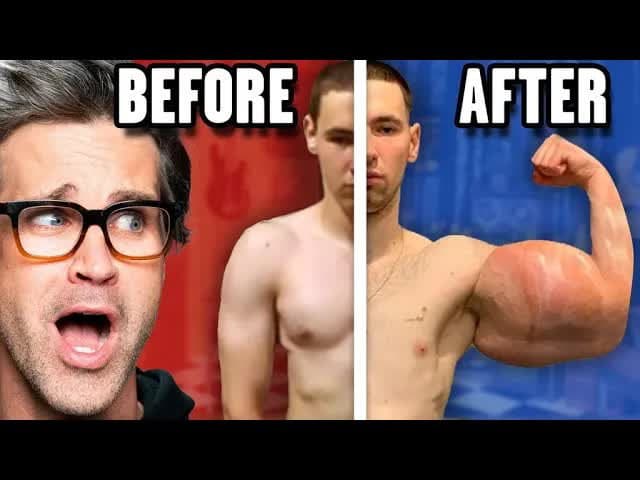 Still from Reacting To Extreme Before And After Photos
