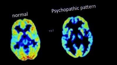 Still from What Makes a Psychopath?